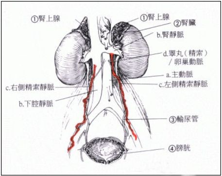 阴囊松弛睾丸下垂巨型图片