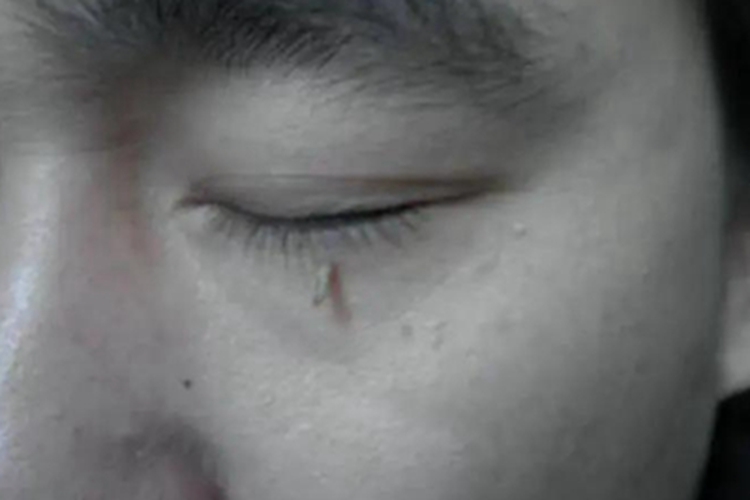 丝状疣眼睛下边小肉条图