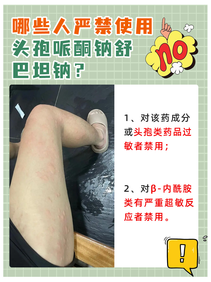 揭秘注射用头孢哌酮钠舒巴坦钠的作用与功效！