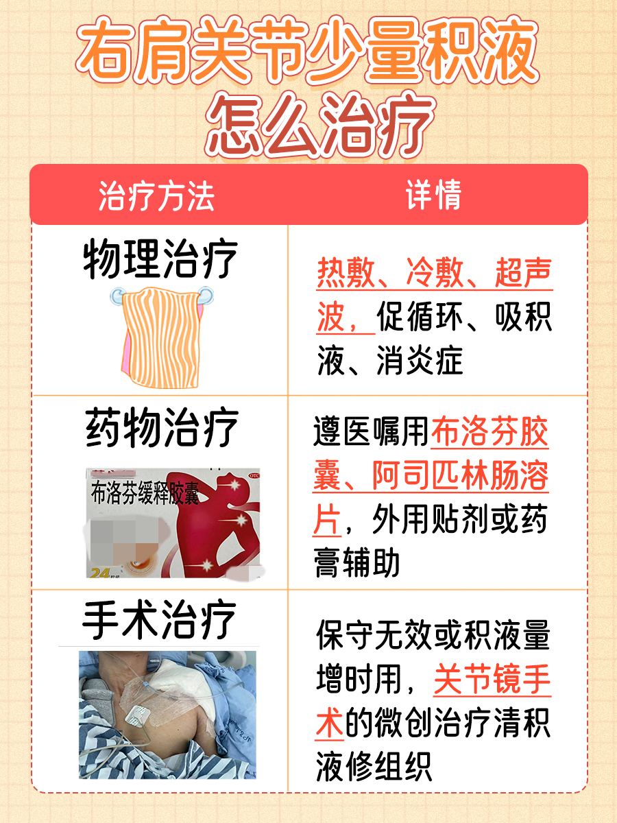 一文解析，右肩关节少量积液怎么治疗