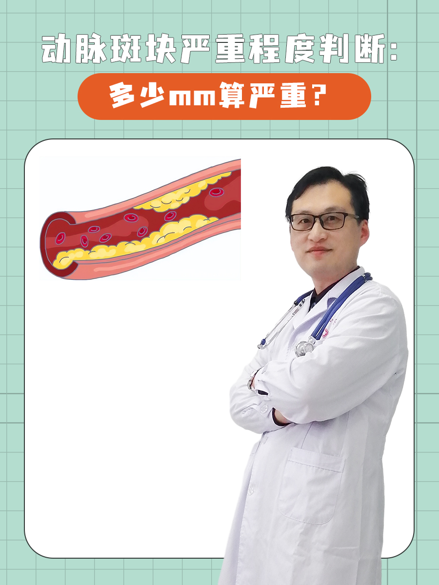 动脉斑块严重程度判断：多少mm算严重？