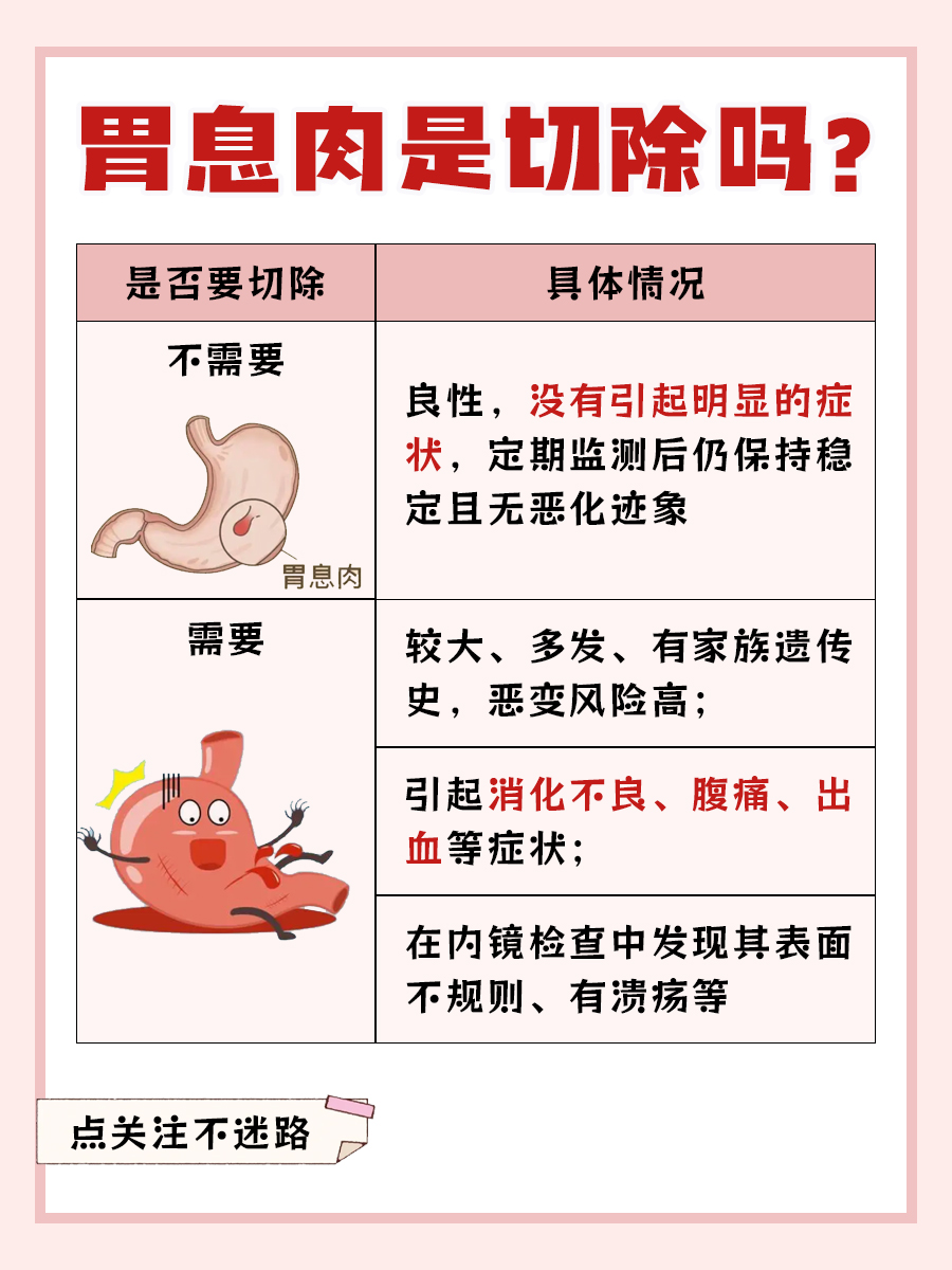 探究：胃息肉是否一定要切除？