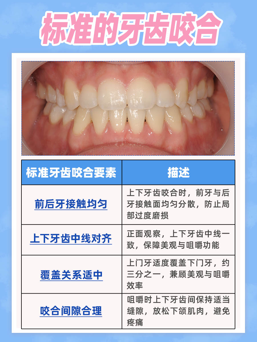 标准的牙齿咬合图