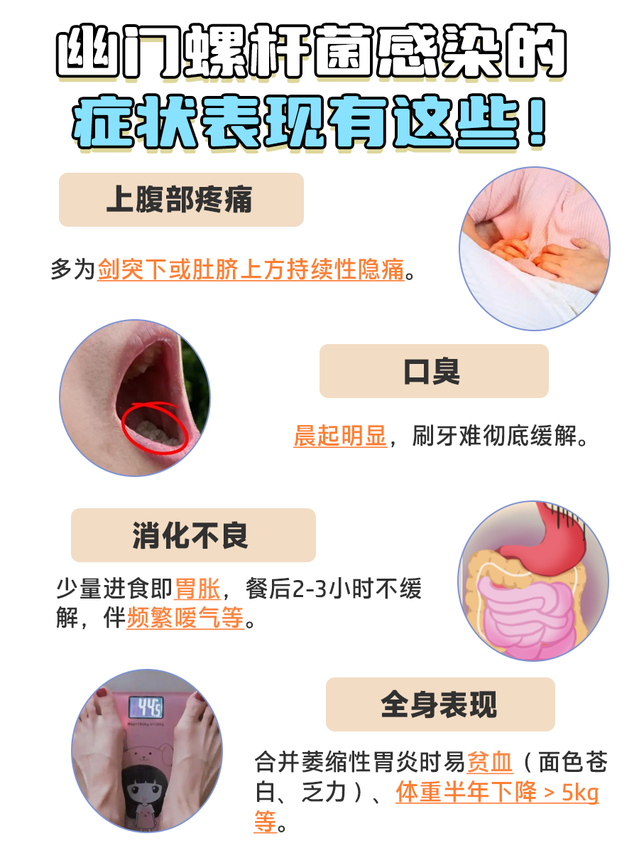 幽门螺杆菌感染的症状表现,越早发现越好!