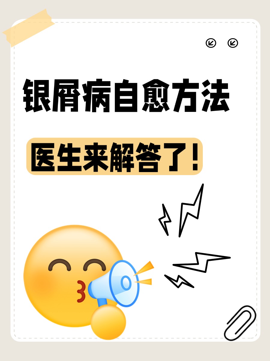 银屑病自愈方法,医生来解答了!