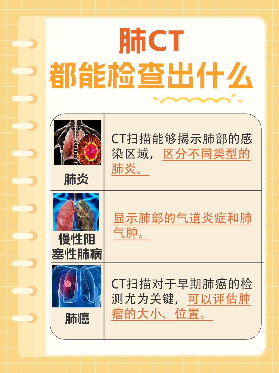 透视肺部:CT扫描揭示的秘密