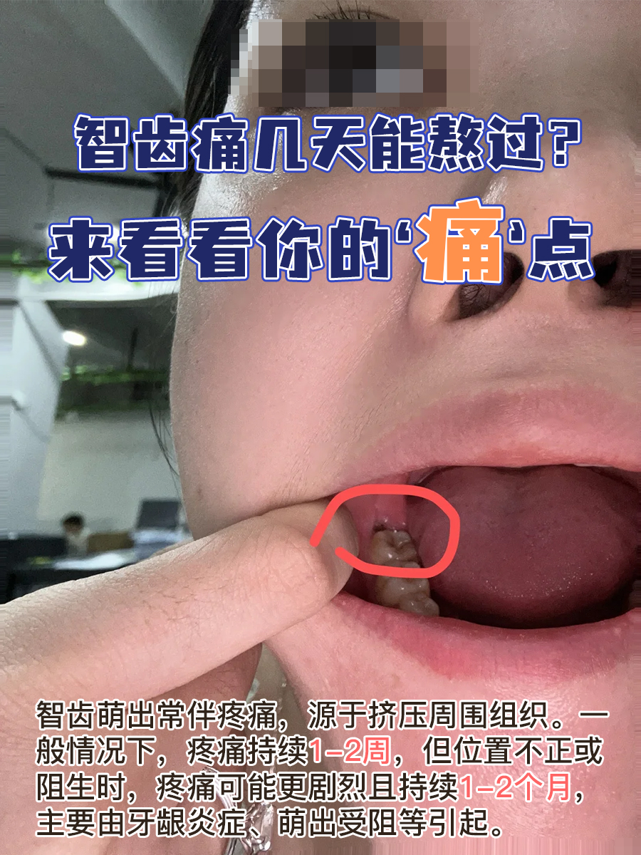 智齿痛几天能熬过?来看看你的‘痛’点