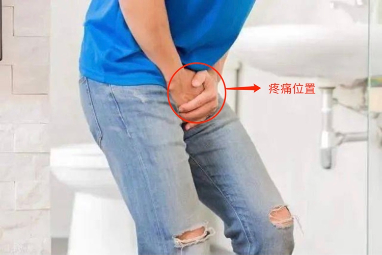 尿道结石疼痛症状图