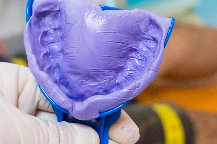 制取牙齿印模图