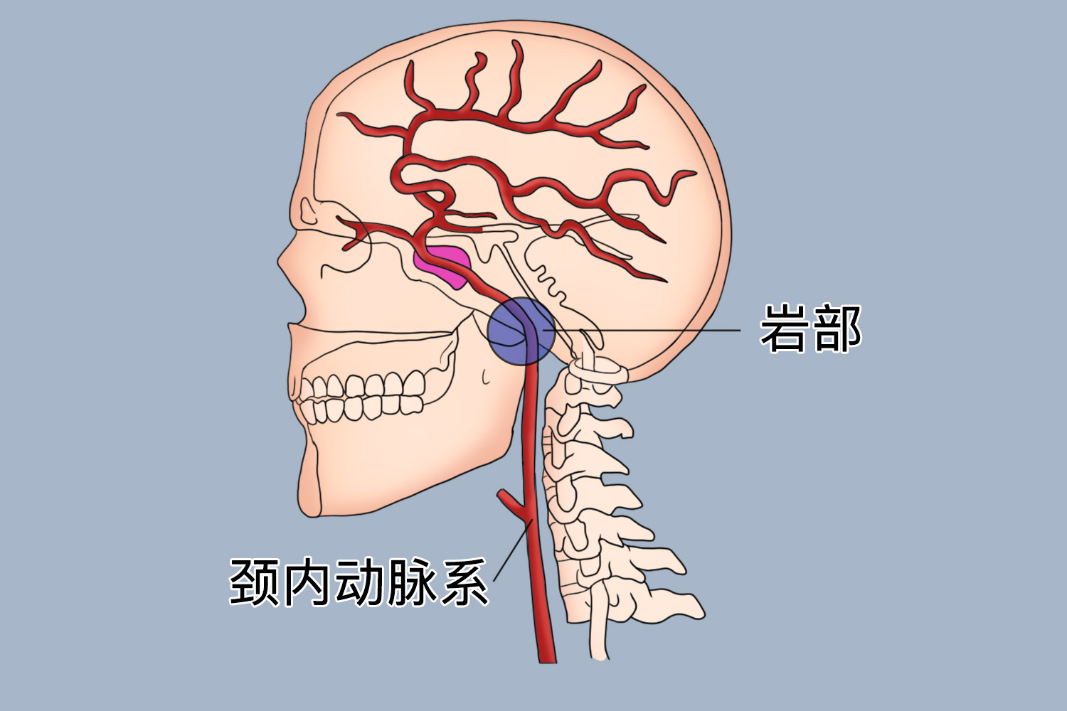 颈内动脉岩部图