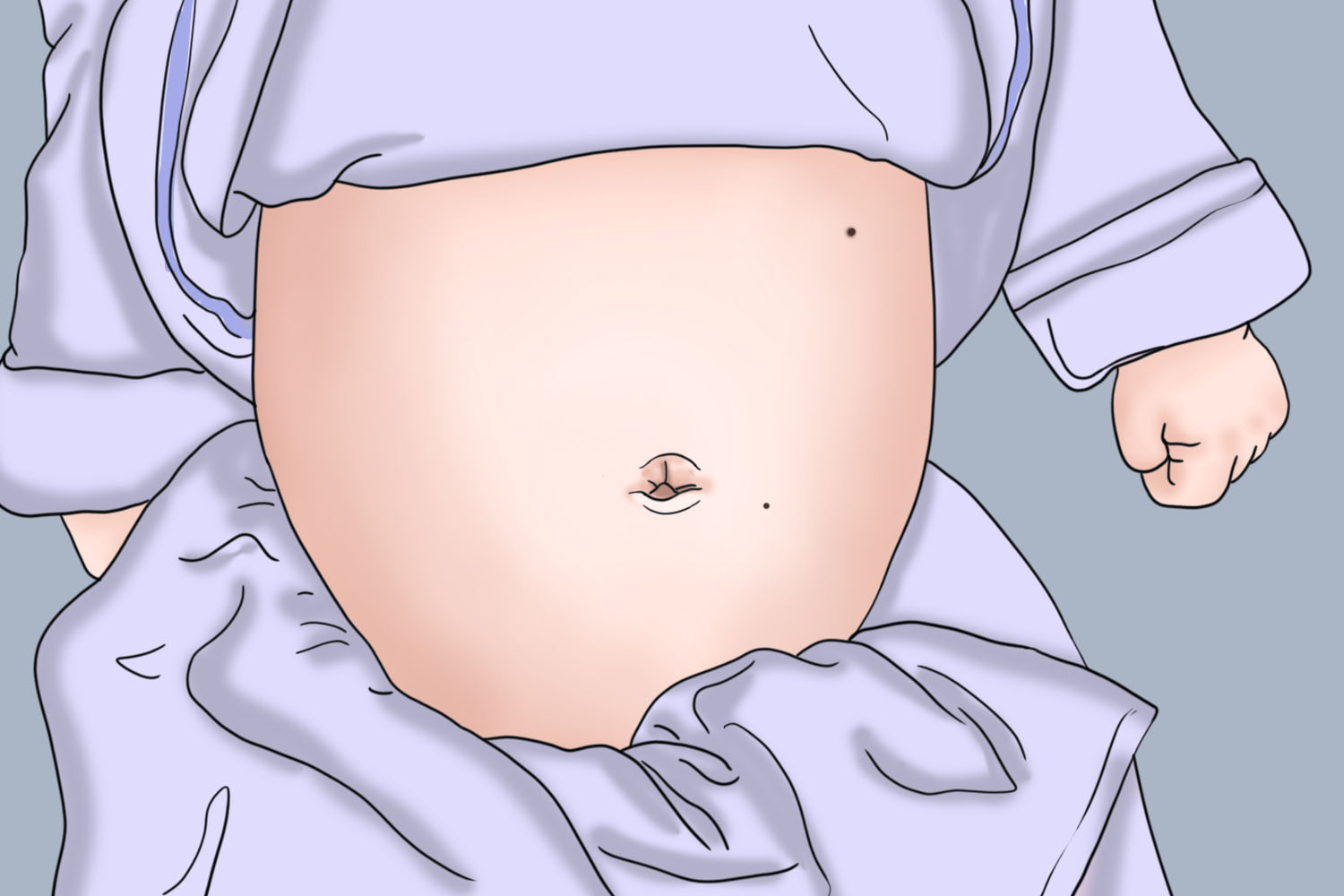 小孩肚子上色素痣图 小孩肚子上色素痣图