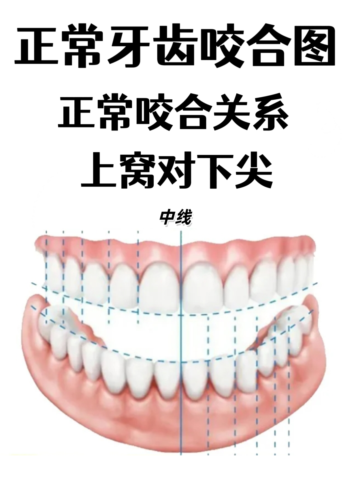正常牙齿咬合是什么样的？看完就知道了