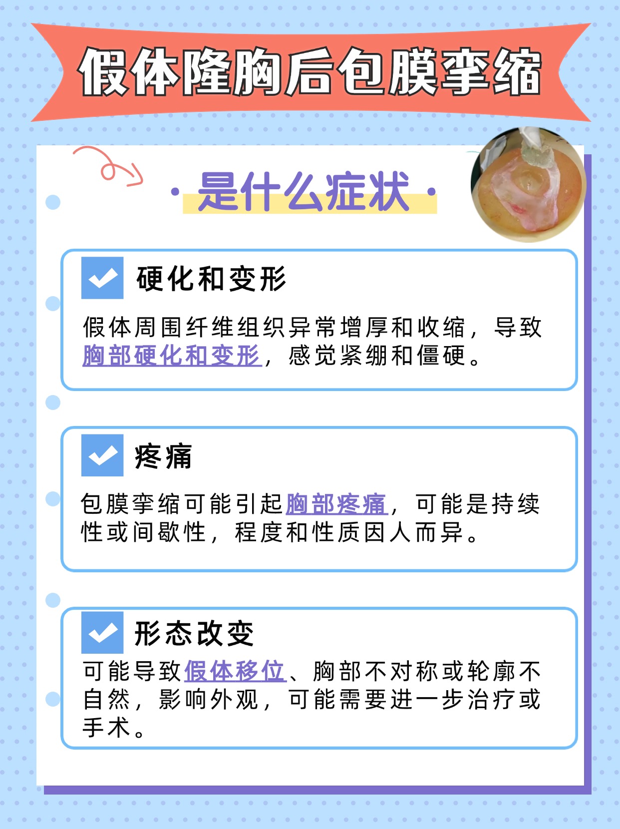 假体隆胸包膜挛缩：症状与应对