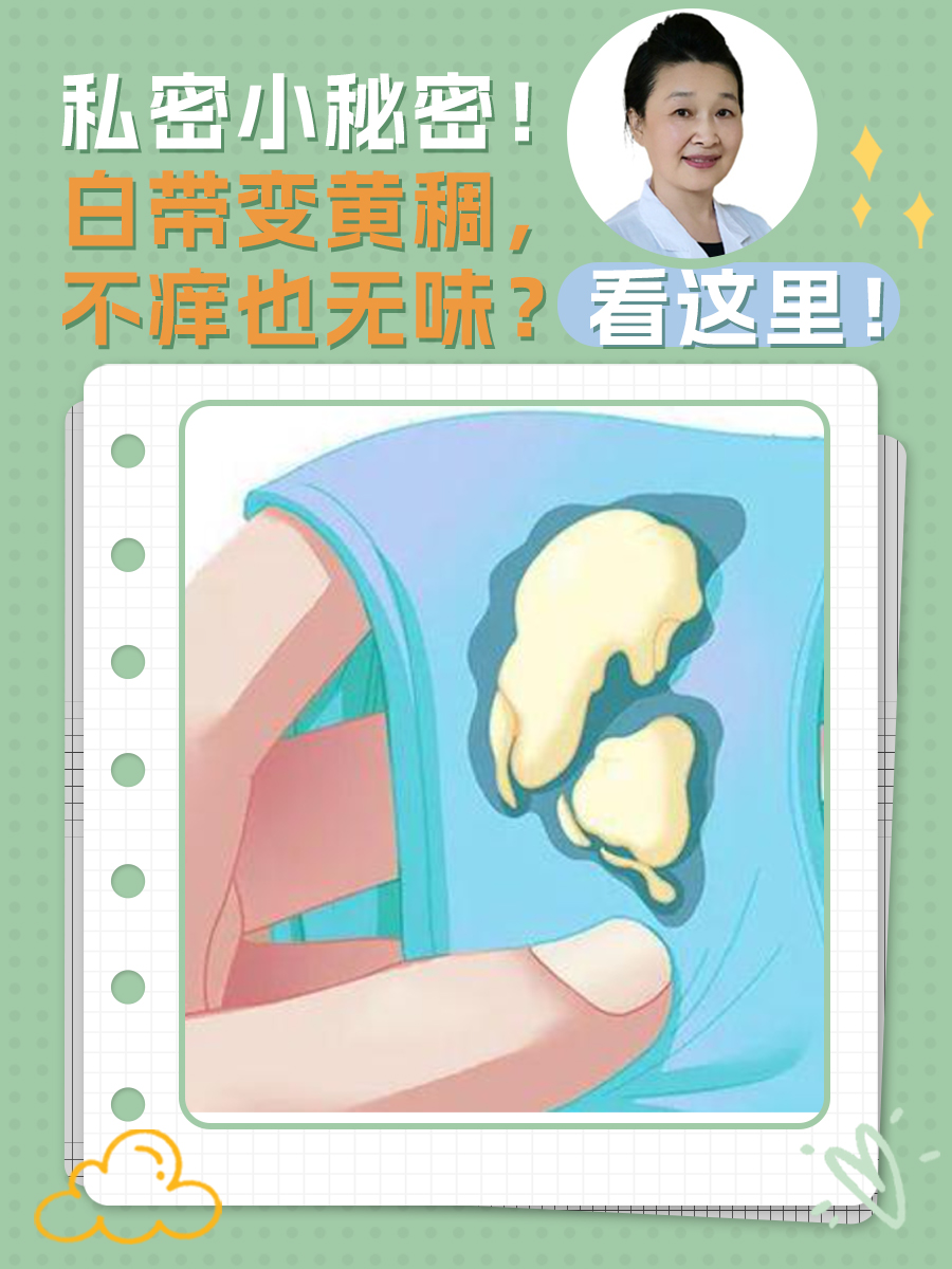 私密小秘密!白带变黄稠,不痒也无味?看这里!