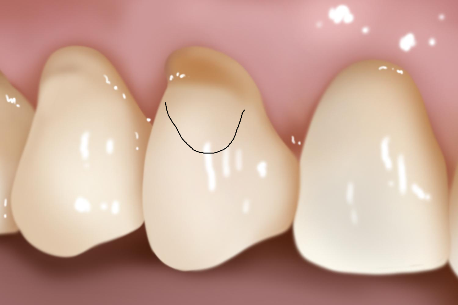 设计洞形图 设计洞形图