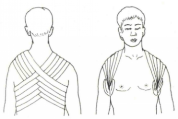 "8"字包扎法图 "8"字包扎法图