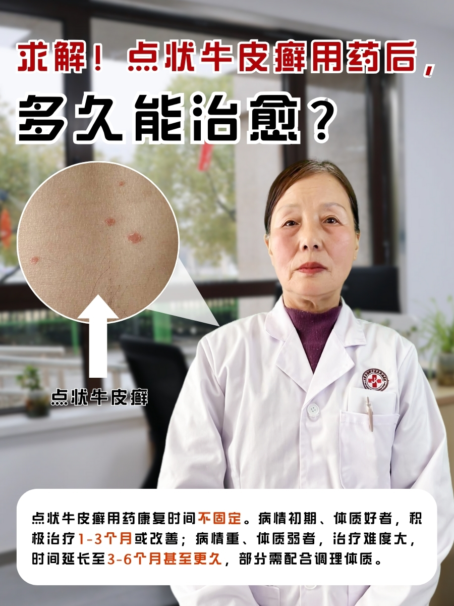 求解!点状牛皮癣用药后,多久能治愈?