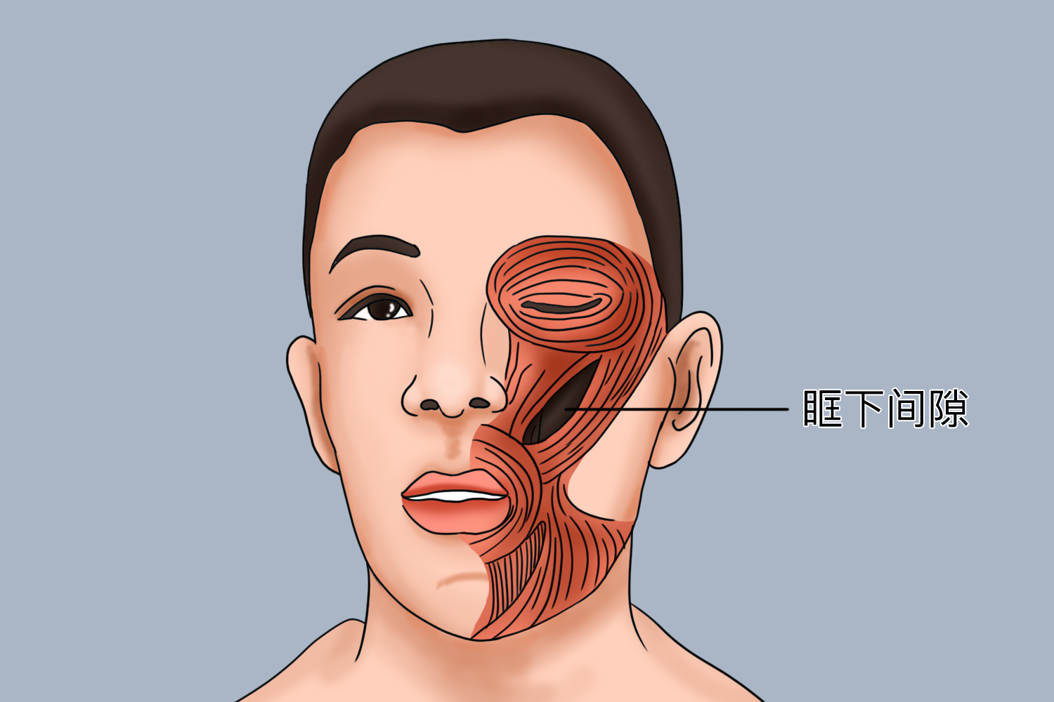 眶下间隙感染位置图