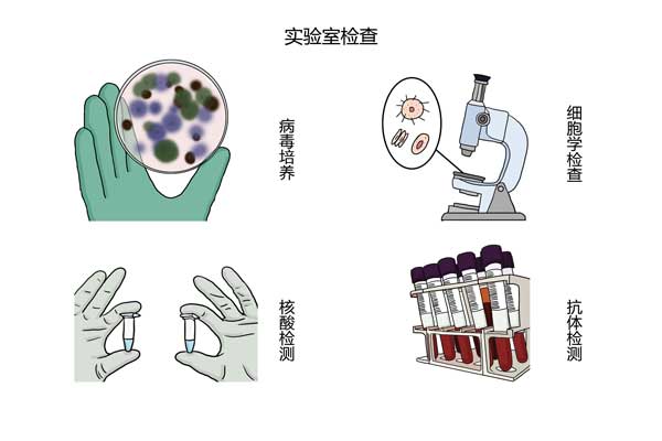 2,實驗室檢查:病毒培養,核酸檢測,抗體檢測或者細胞學檢查可以幫助