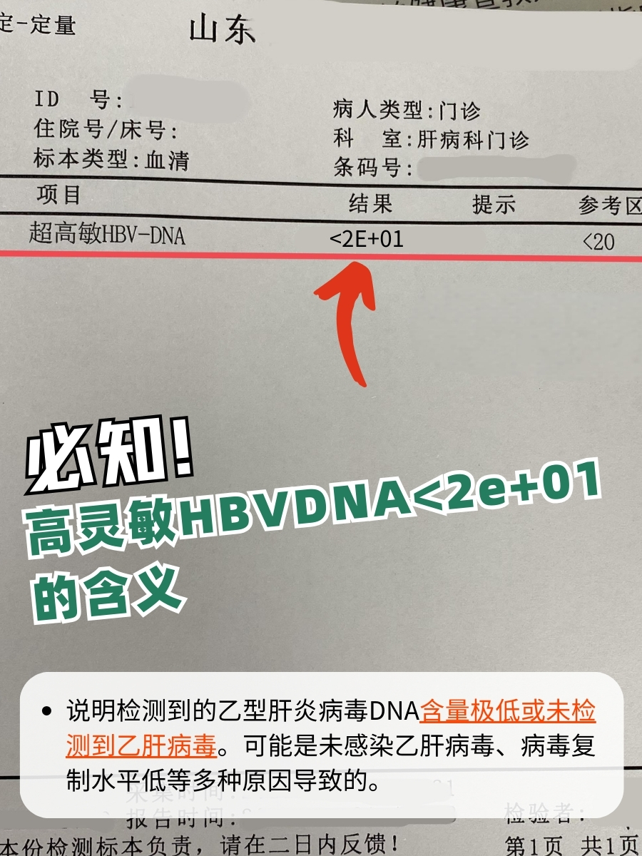 必知!高灵敏HBVDNA<2e+01的含义