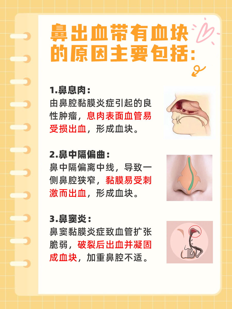 鼻出血带有血块的原因解析
