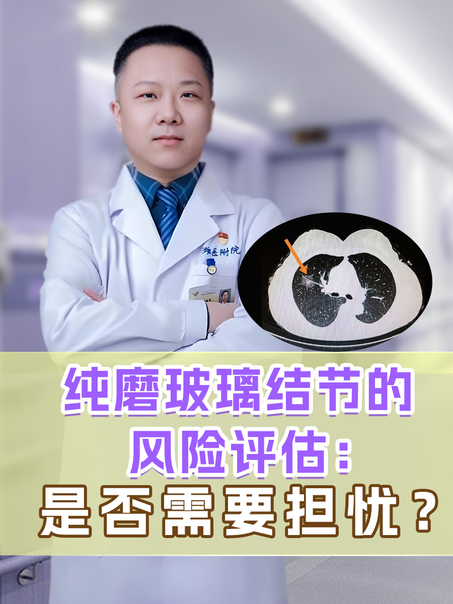 纯磨玻璃结节的风险评估：是否需要担忧？