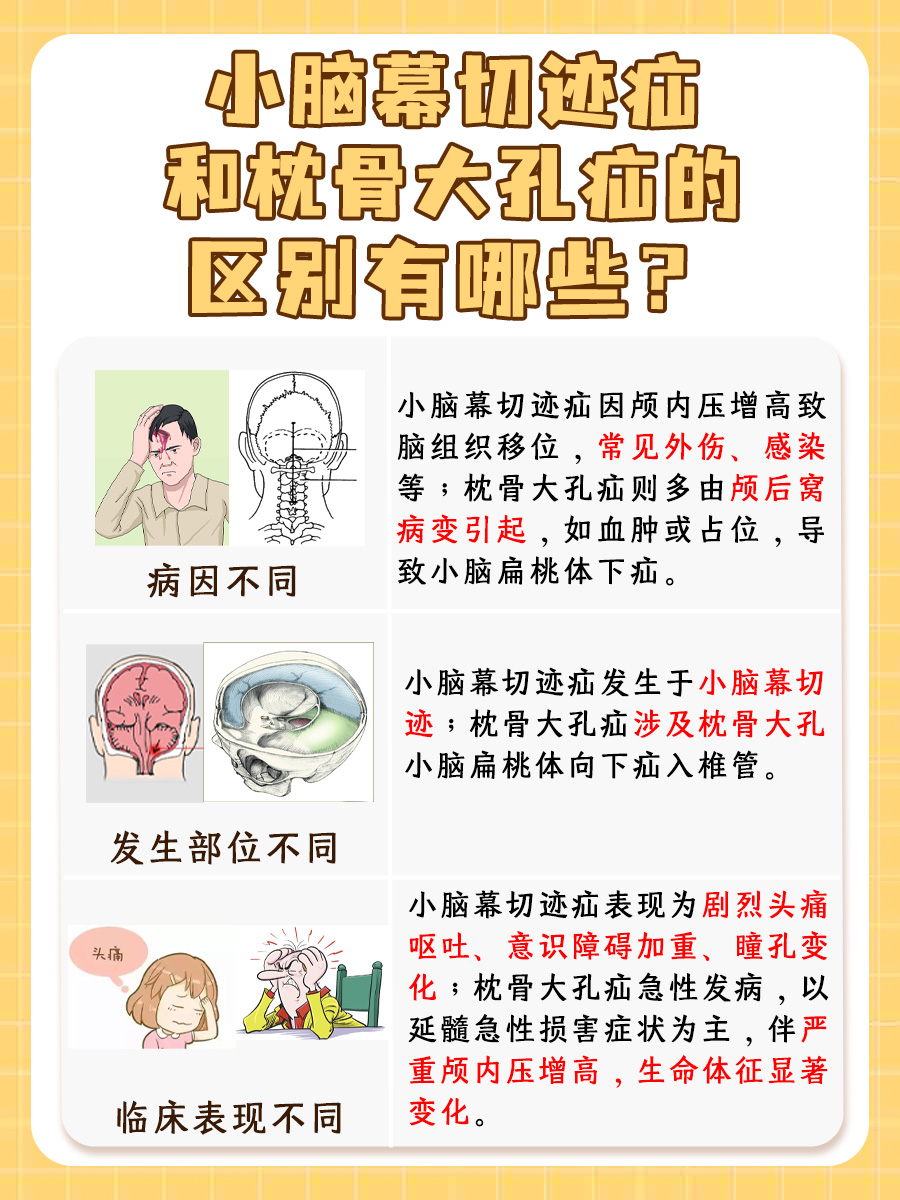 小脑幕切迹疝和枕骨大孔疝的区别，答案来了