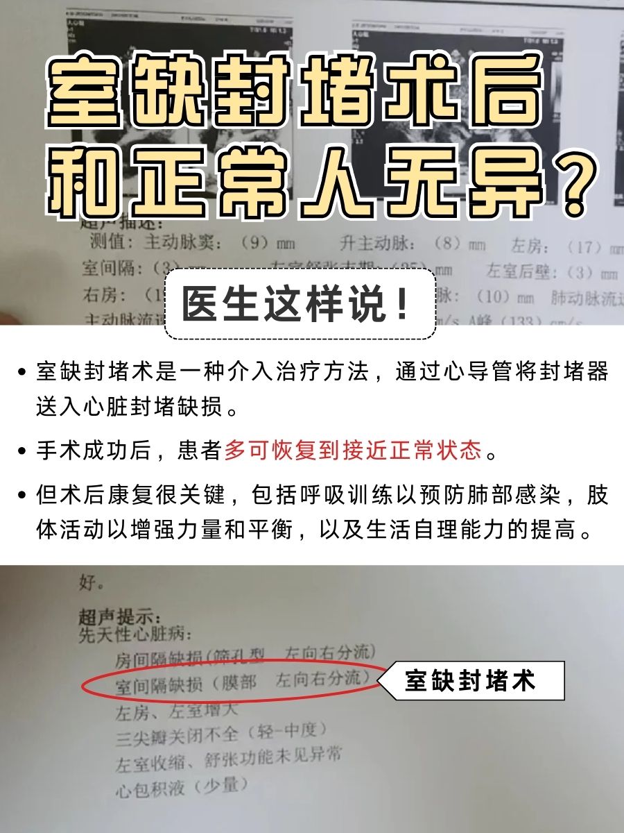 室缺封堵术后,和正常人无异?医生这样说!