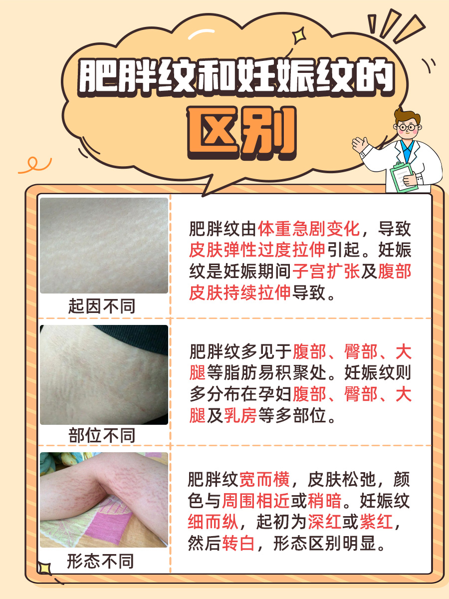医生揭秘：肥胖纹和妊娠纹有哪些区别？