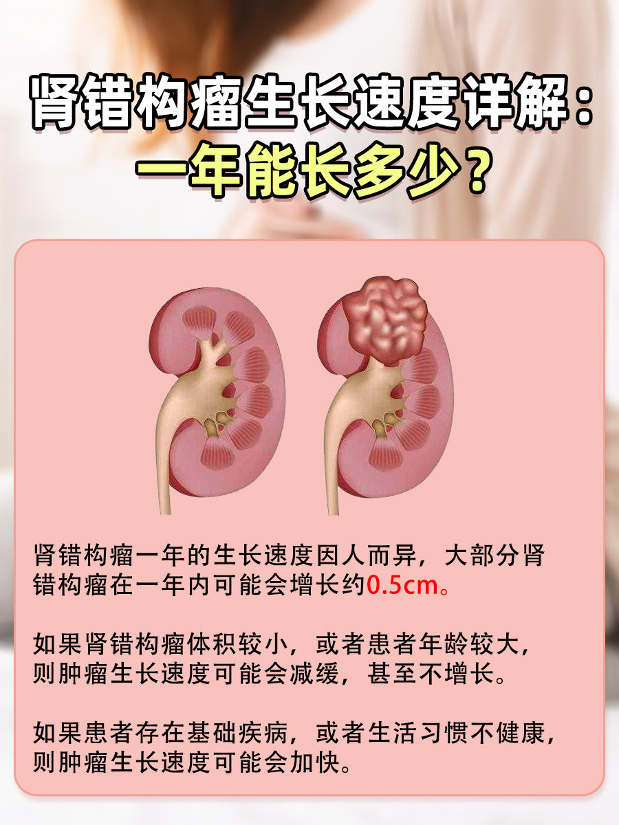 肾错构瘤生长速度详解：一年能长多少？