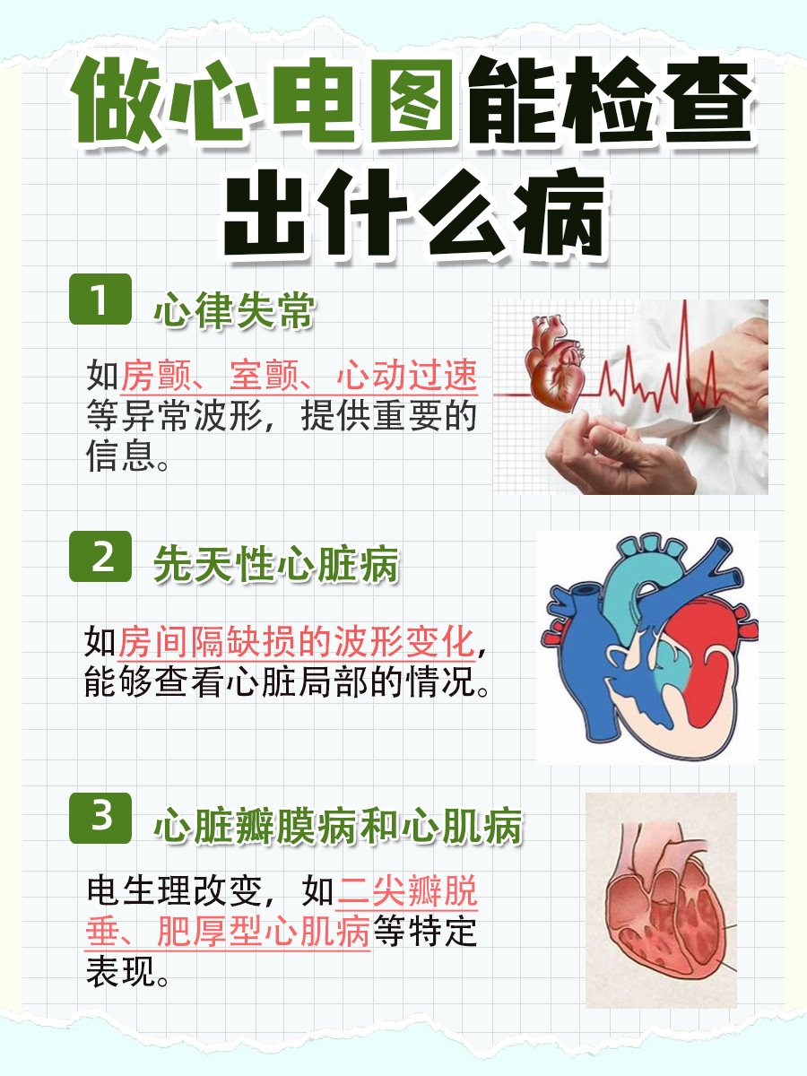 做心电图能检查出什么病，名单来了