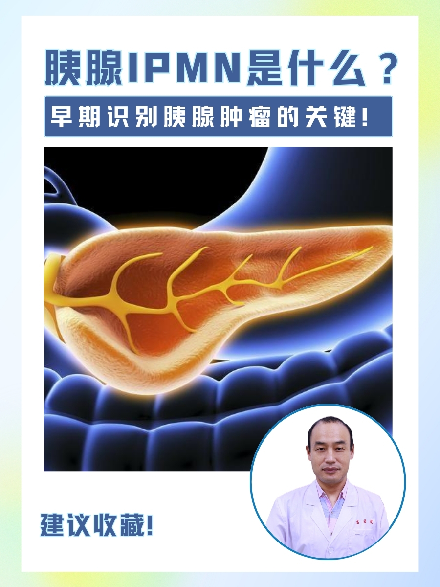 胰腺IPMN是什么？早期识别胰腺肿瘤的关键！