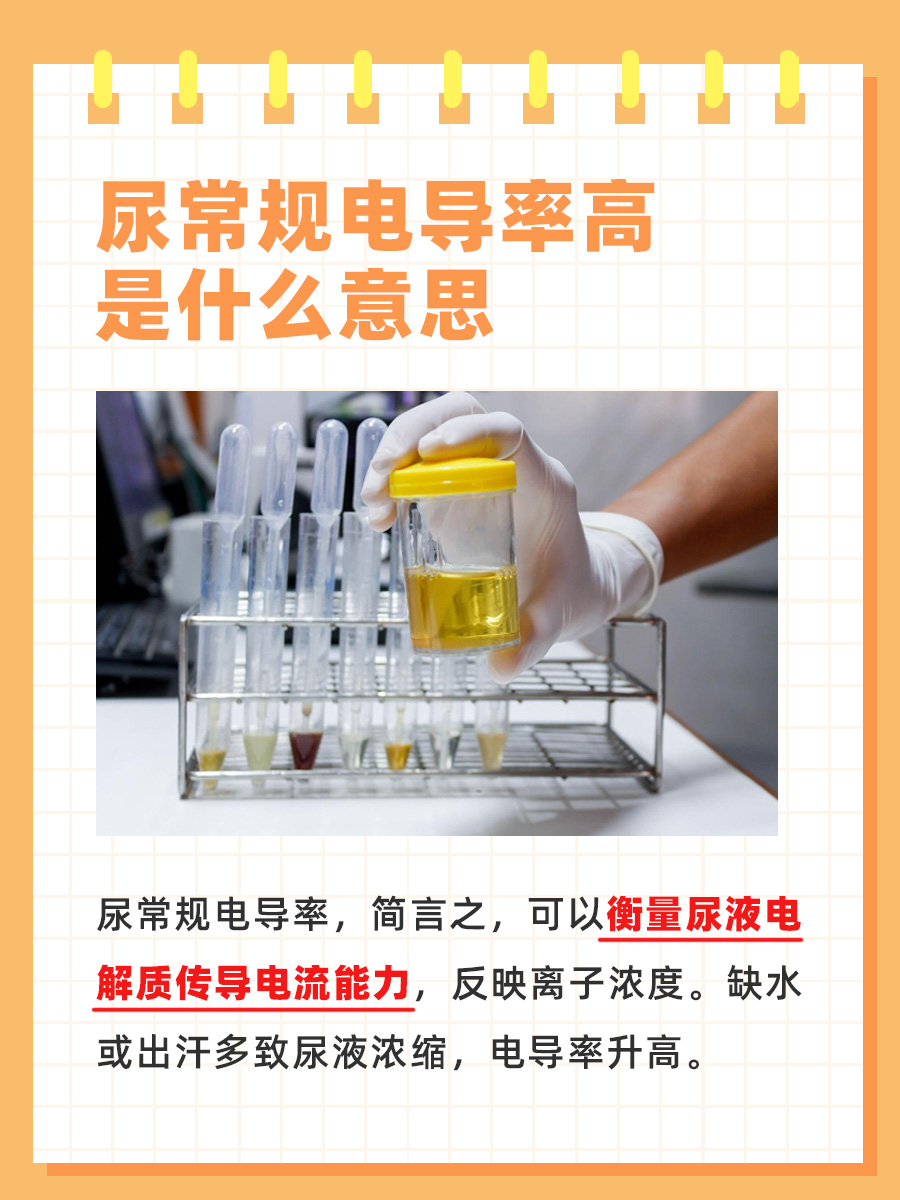 一文解析：尿常规电导率高是什么意思？