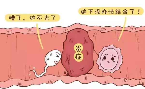 盆腔炎.webp_副本.jpg