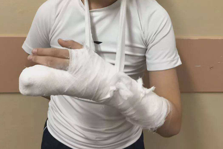儿童手腕石膏包扎图