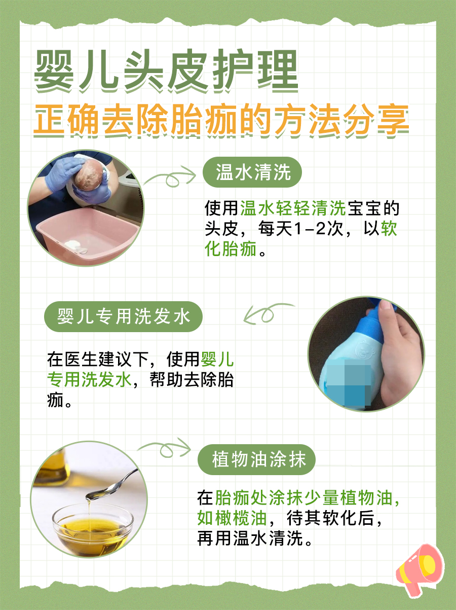 宝宝头顶胎痂护理指南:去除小技巧