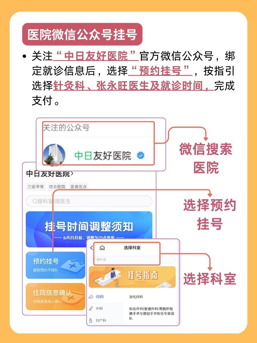 中日友好医院张永旺医生怎么样？怎么挂号？