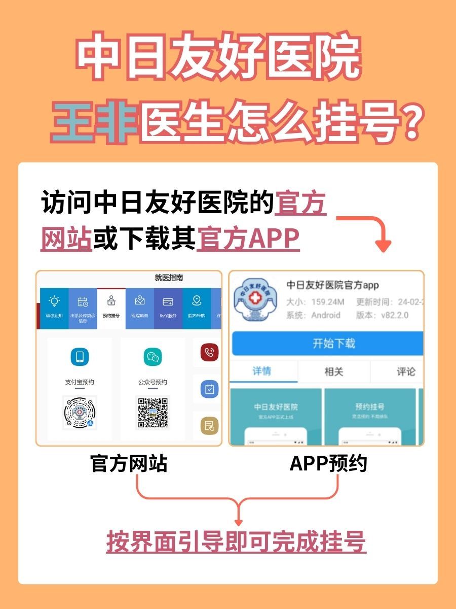 中日友好医院王非医生怎么样？怎么挂号？