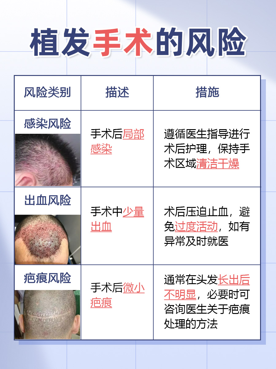 植发价格大起底：探究真相