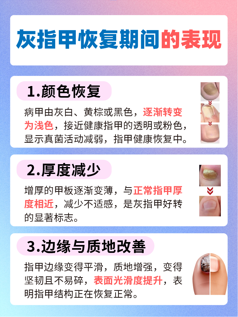 仔细瞧——灰指甲慢慢变好的迹象
