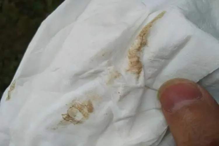 受精卵着床流褐色分泌物图