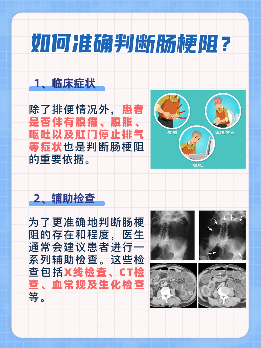 肠梗阻？看排便情况就知一二！