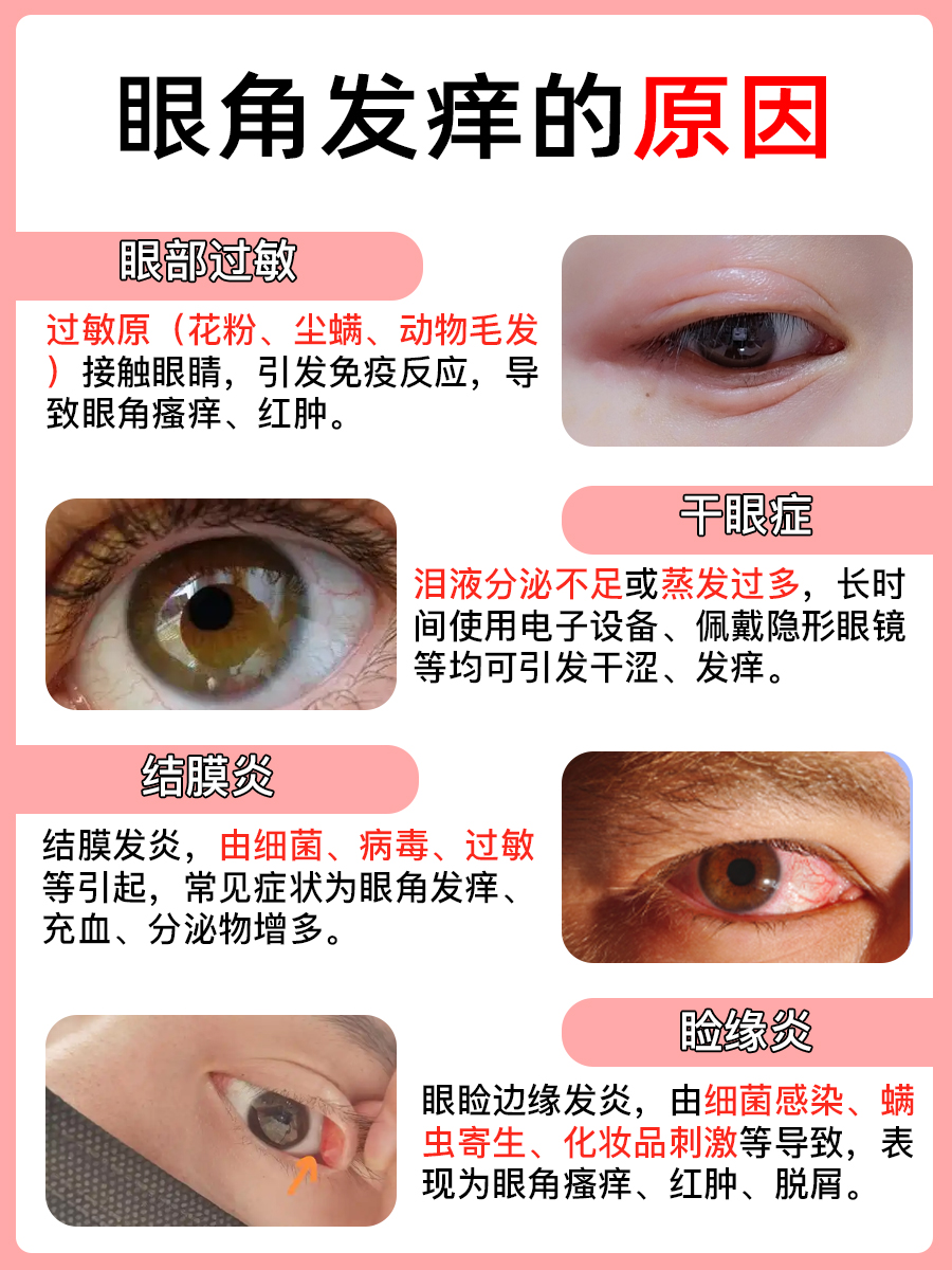眼角发痒别轻视，这些原因要重视