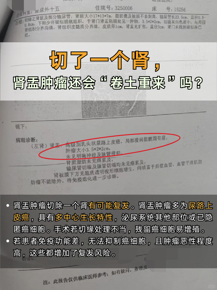 切了一个肾，肾盂肿瘤还会“卷土重来”吗？