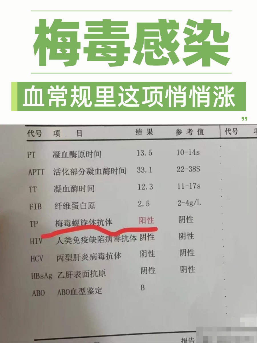 梅毒感染，血常规里这项悄悄涨