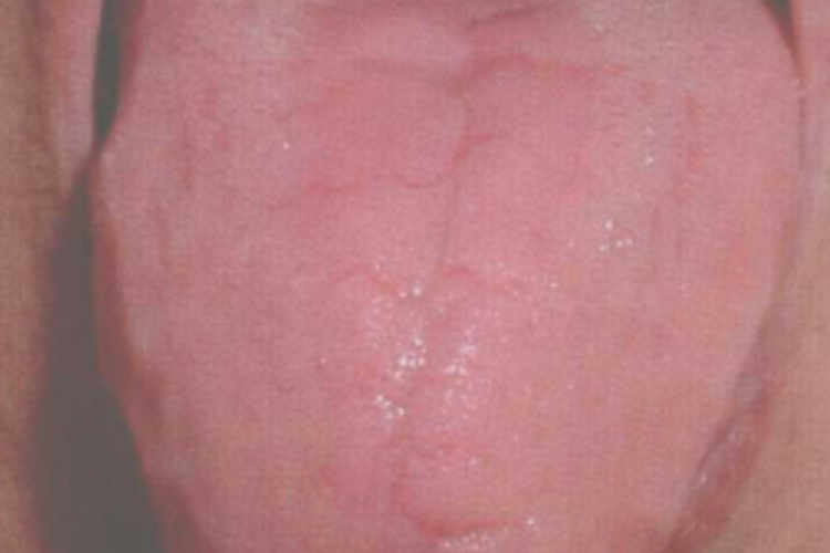 中剥苔图 中剥苔图