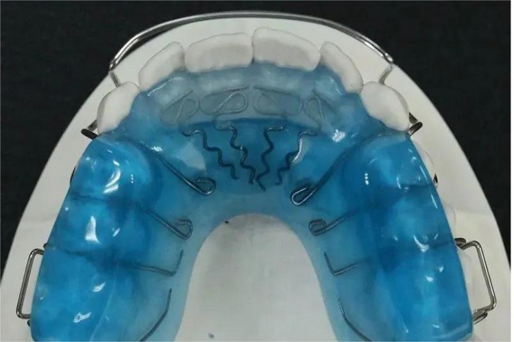 (牙合)垫式活动矫治器图