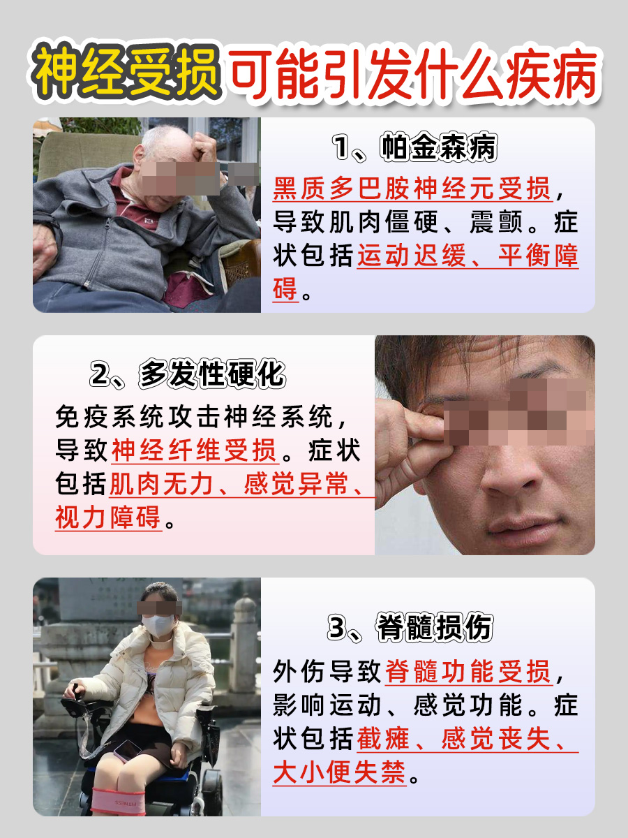 神经知多少?一文带你全搞懂!别再一知半解