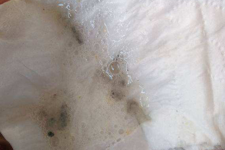 戒烟70多天咳黑痰图 戒烟70多天咳黑痰图