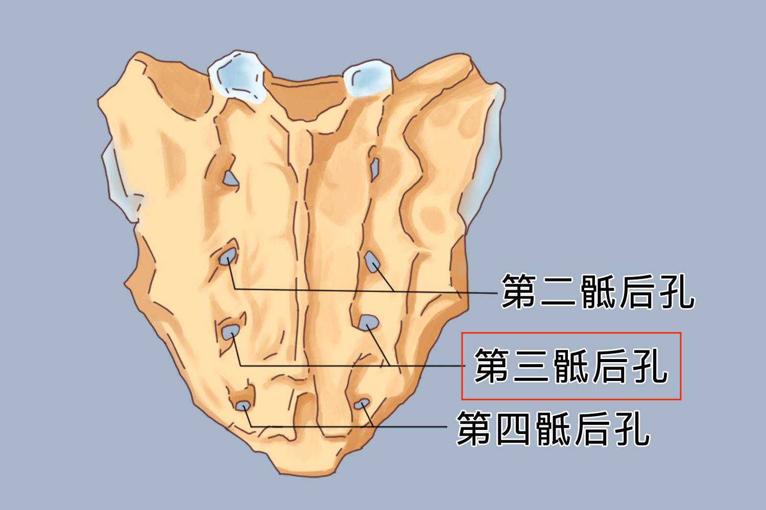 第三骶后孔位置图 第三骶后孔位置图
